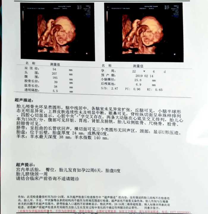 宝宝四维彩超照片很丑，原来是这2个原因，孕妇破涕为笑了